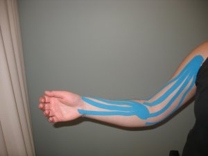 Kinesio Taping – Care Chiropractic – Health & Rehab